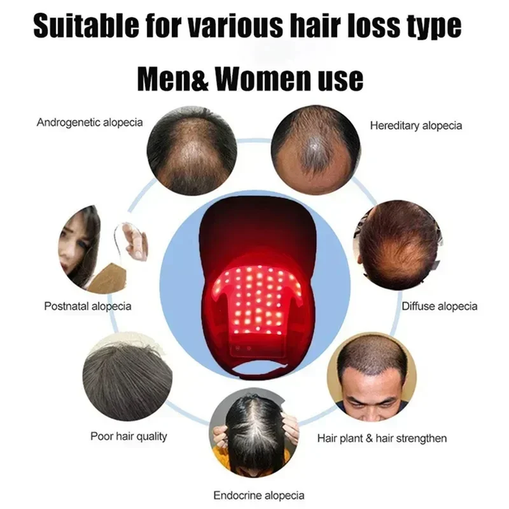 Red Light Hair Growth Cap Infrared Anti-hair Loss Therapy Device Prevents Hair Loss and Promotes Scalp Blood Circulation