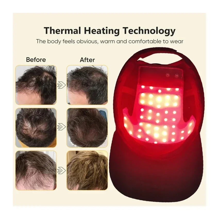Red Light Hair Growth Cap Infrared Anti-hair Loss Therapy Device Prevents Hair Loss and Promotes Scalp Blood Circulation